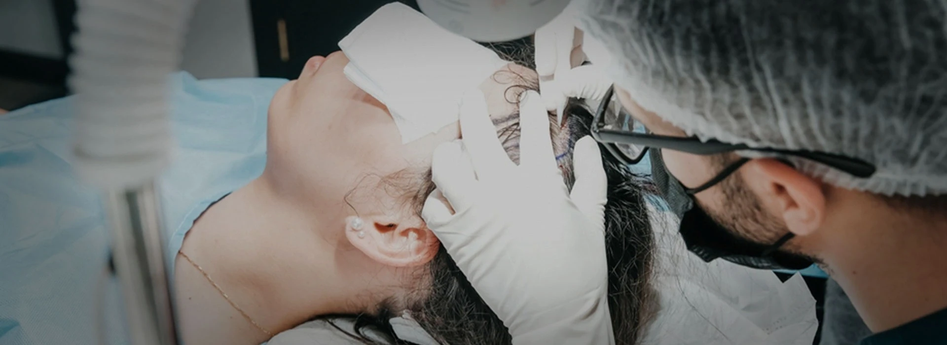 Hair Transplant For Female